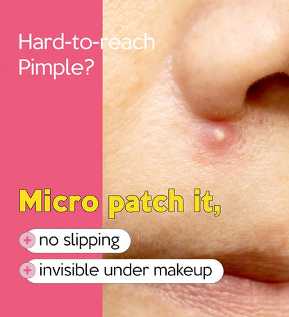 Troubless Invisible Pimple Spot Patch The Micro Signature