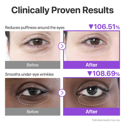 Numbuzin No.9 NAD Collagen Under eye patches 5ea