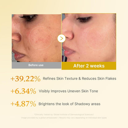Medicube Glycolic