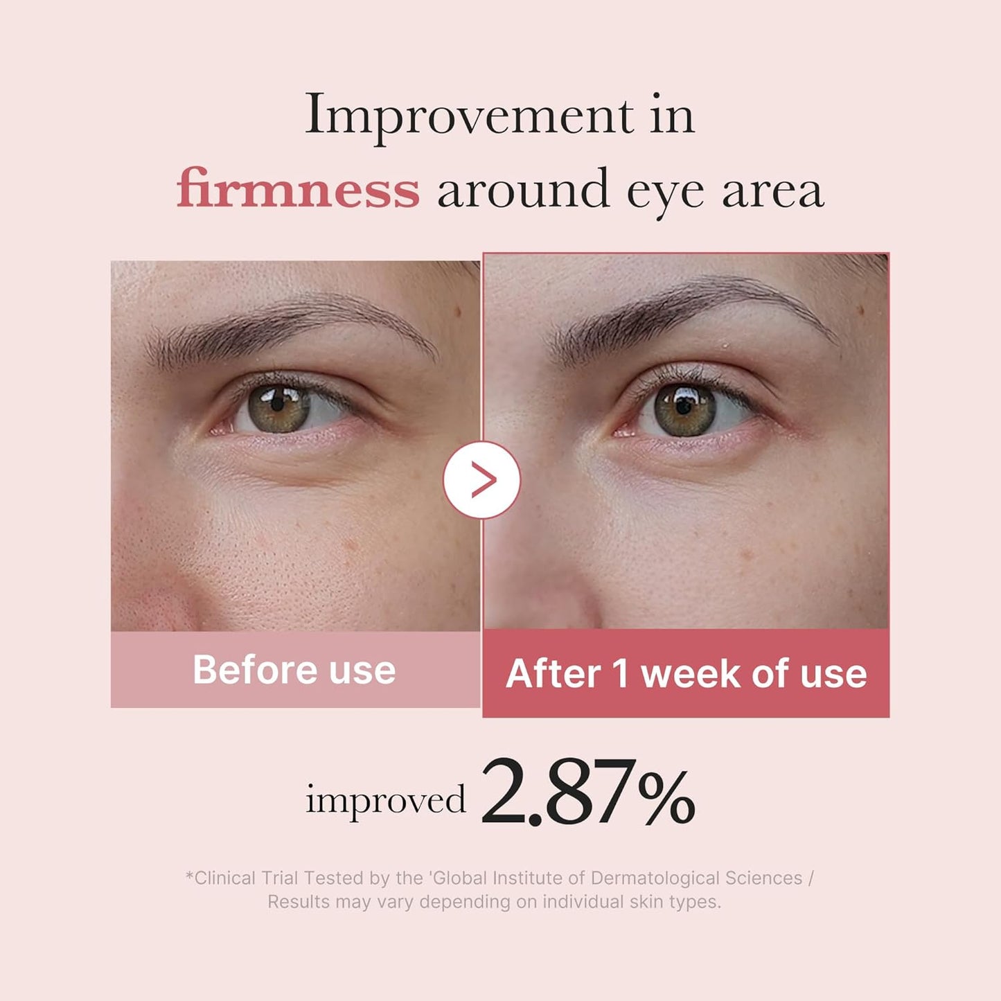 Medicube PDRN Pink peptide eye serum 30ml