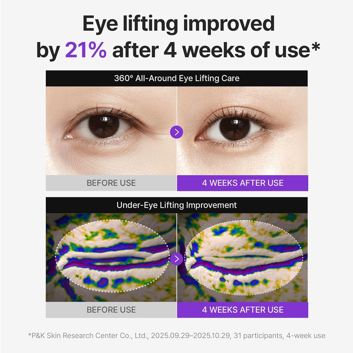 Centellian24 360 Shot PDRN lifting eye cream