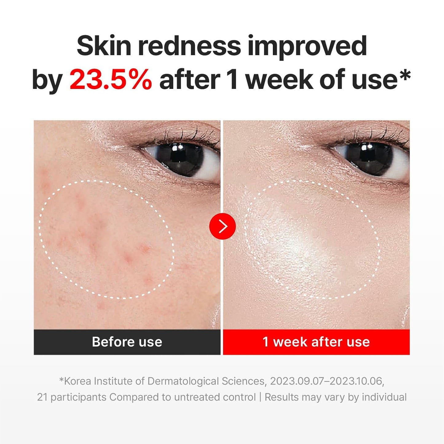 Centellian24 Madeca Cream Time Reverse 50ml