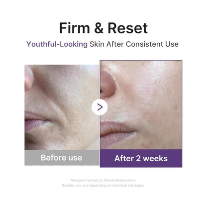 Medicube Retinol NMN Boosting Serum