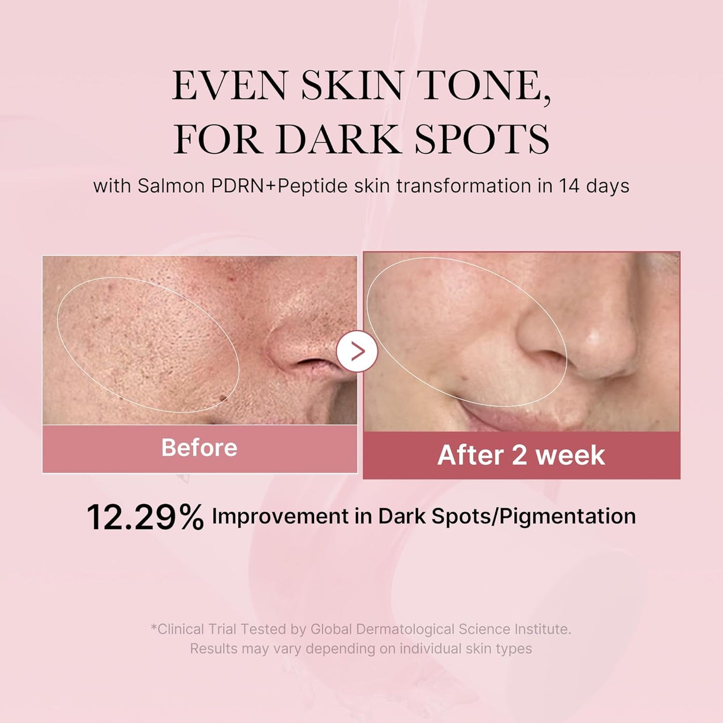 Medicube PDRN Pink Cica Soothing Toner