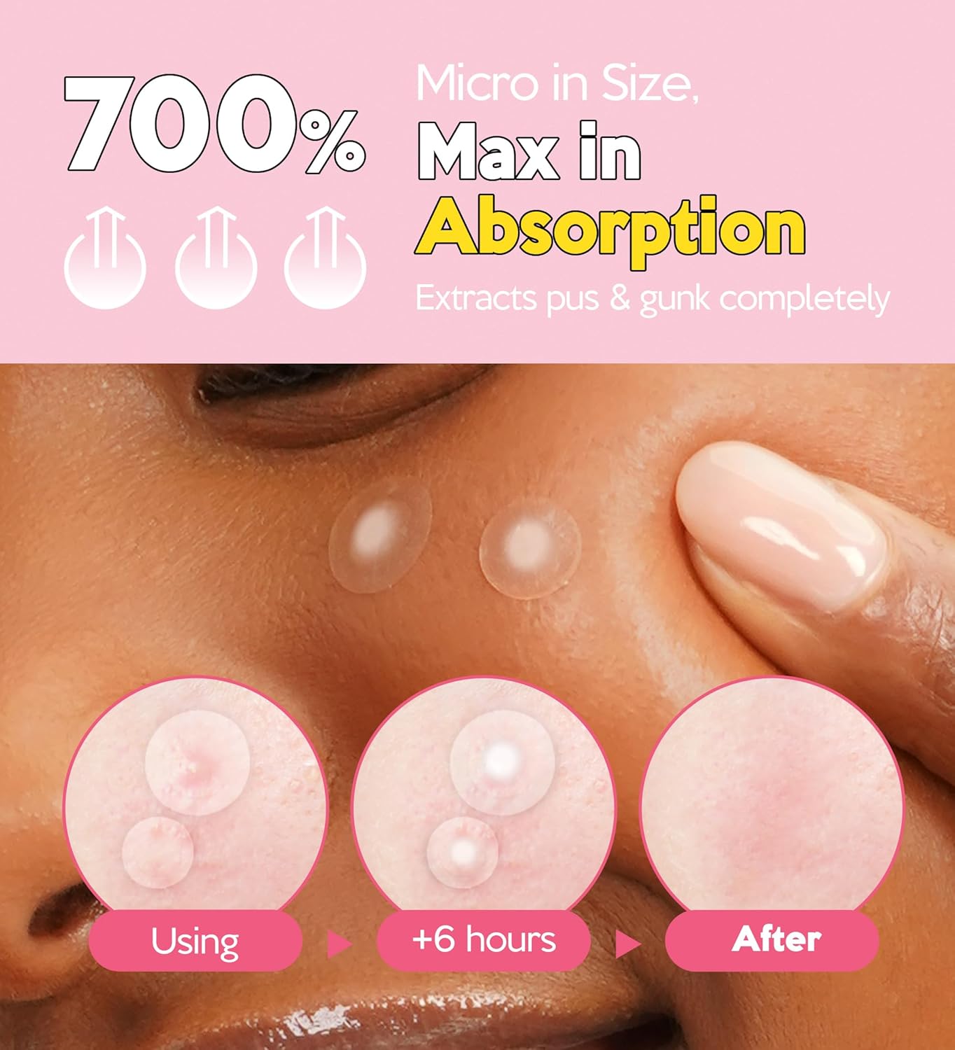 Troubless Invisible Pimple Spot Patch The Micro Signature