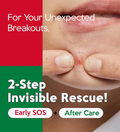 Troubless Invisible Pimple Spot Patch Early Sos + After Care
