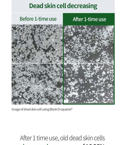 Benton Aloe Bha Skin Toner 200ml