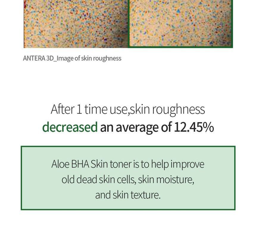 Benton Aloe Bha Skin Toner 200ml