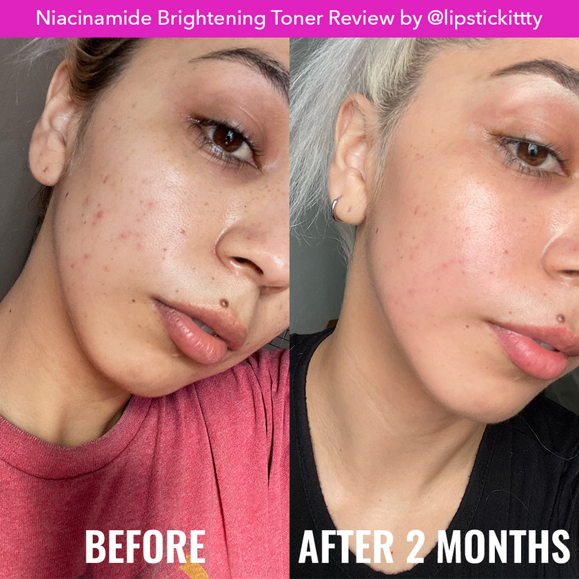 Good Molecules Niacinamide Brightening